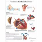 Common Cardiac Disorders, 1001526 [VR1343L], Sistema Cardiovascular